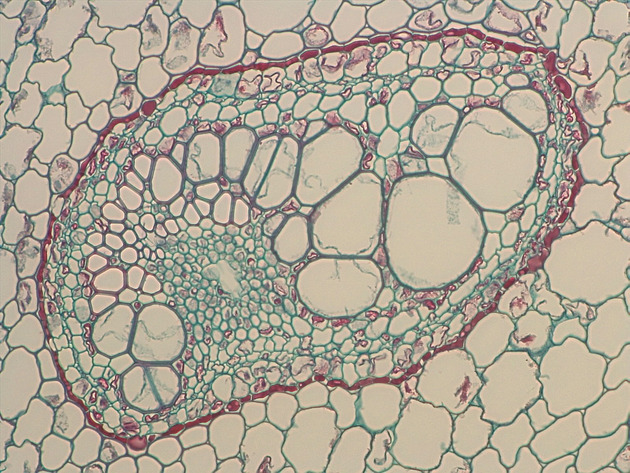Fern Stem Slides - Fernstem 01 400X